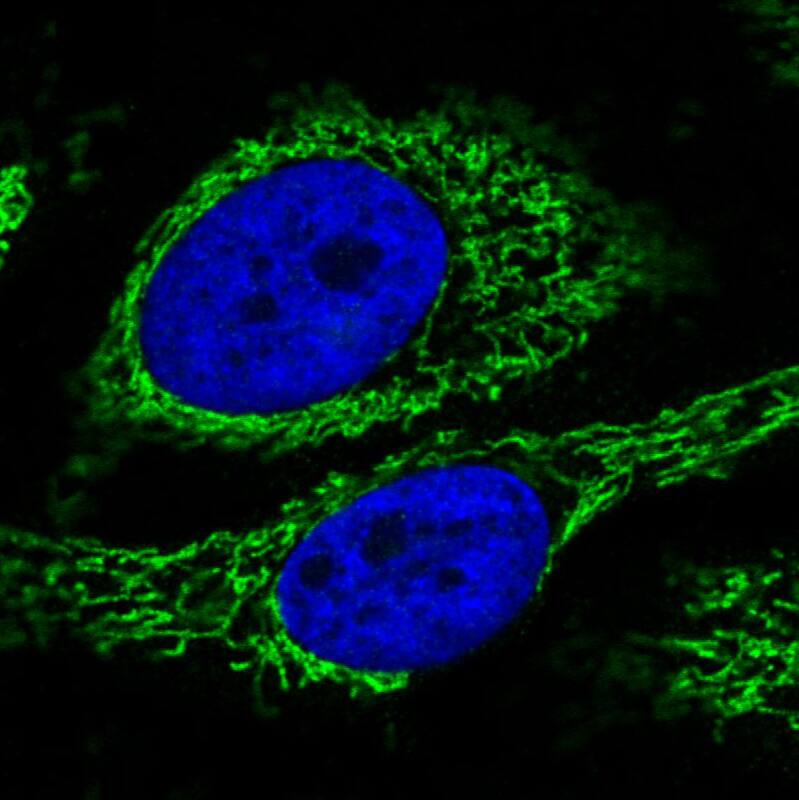CS Citrate Synthase Antibody (CL2553) - BSA Free Immunocytochemistry/ Immunofluorescence: CS Citrate Synthase Antibody (CL2553) [NBP2-36773]