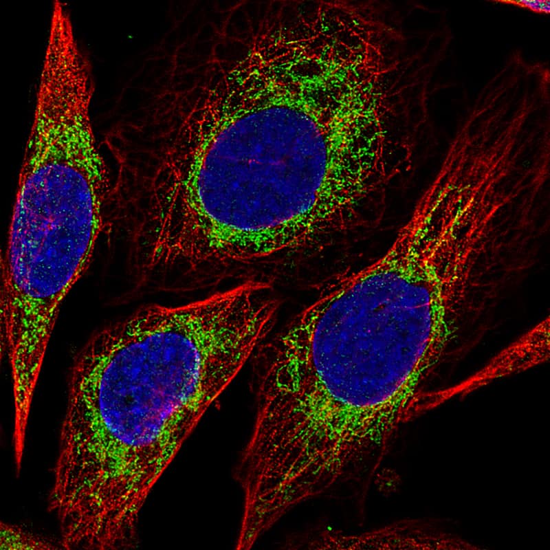 CS Citrate Synthase Antibody (CL2561) - BSA Free Immunocytochemistry/ Immunofluorescence: CS Citrate Synthase Antibody (CL2561) [NBP2-36774]