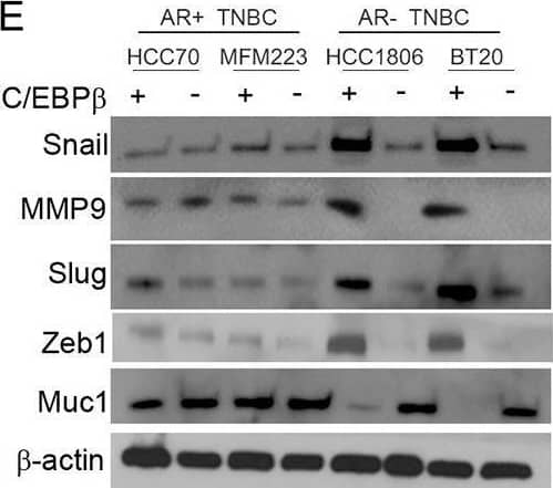 CEBP Beta Antibody (3H9)