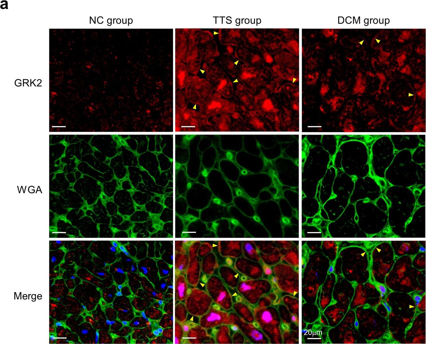 GRK2 Antibody (3F8) - BSA Free