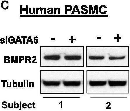BMPR-II Antibody (3F6)
