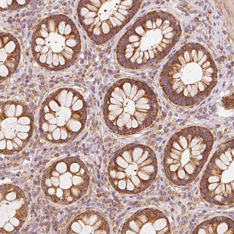 TOMM40 Antibody - BSA Free Immunohistochemistry-Paraffin: TOMM40 Antibody [NBP2-37879]