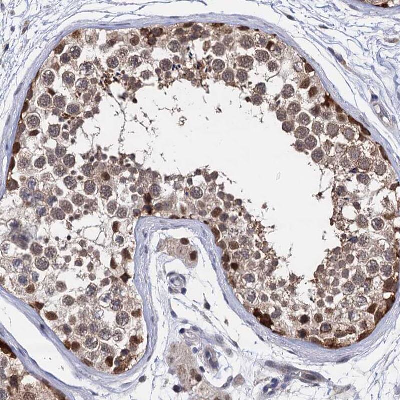S5a/Angiocidin Antibody - BSA Free Immunohistochemistry-Paraffin: S5a/Angiocidin Antibody [NBP2-37888]