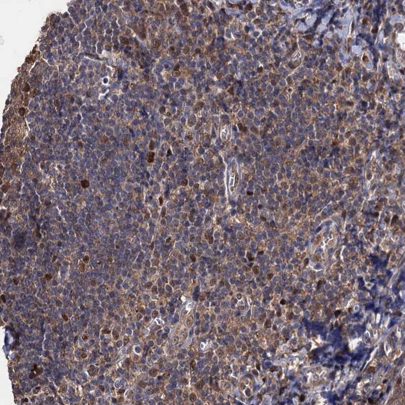 S5a/Angiocidin Antibody - BSA Free Immunohistochemistry-Paraffin: S5a/Angiocidin Antibody [NBP2-37888]