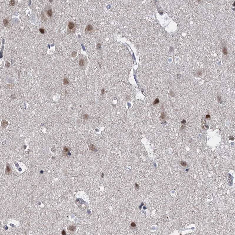 S5a/Angiocidin Antibody - BSA Free Immunohistochemistry-Paraffin: S5a/Angiocidin Antibody [NBP2-37888]