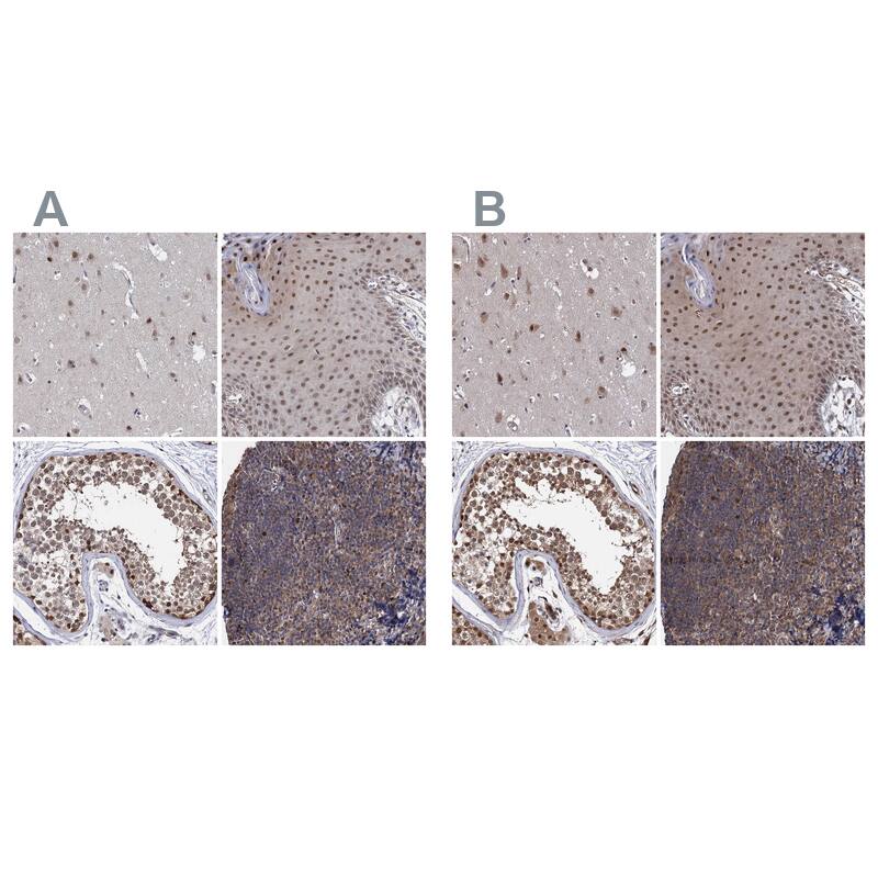 S5a/Angiocidin Antibody - BSA Free Immunohistochemistry-Paraffin: S5a/Angiocidin Antibody [NBP2-37888]
