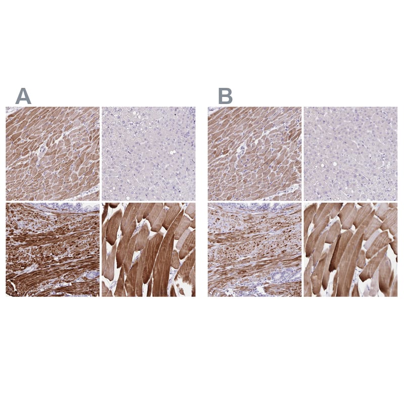 alpha Desmuslin Antibody - BSA Free Immunohistochemistry-Paraffin: alpha Desmuslin Antibody [NBP2-37892]