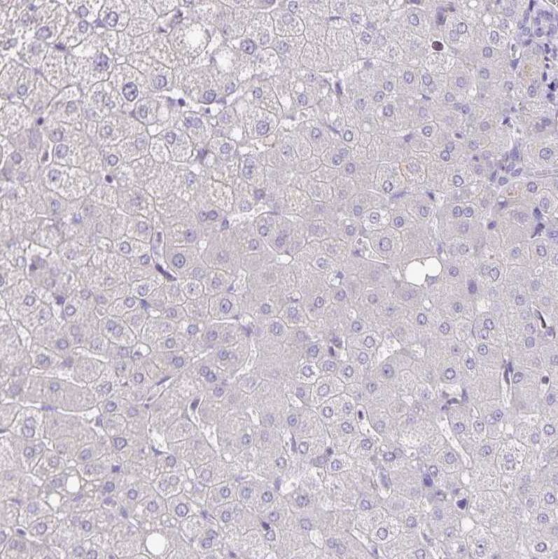 alpha Desmuslin Antibody - BSA Free Immunohistochemistry-Paraffin: alpha Desmuslin Antibody [NBP2-37892]