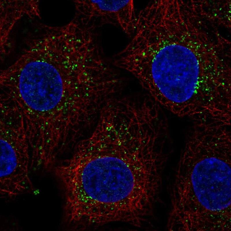 ZADH1 Antibody - BSA Free Immunocytochemistry/ Immunofluorescence: ZADH1 Antibody [NBP2-38122]