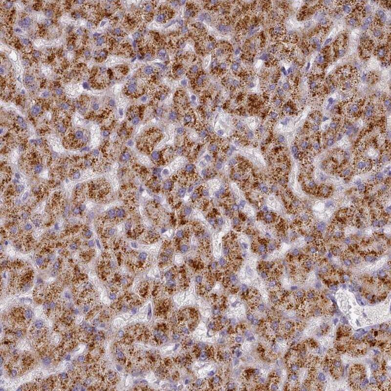 TYW1B Antibody - BSA Free Immunohistochemistry-Paraffin: TYW1B Antibody [NBP2-38128]