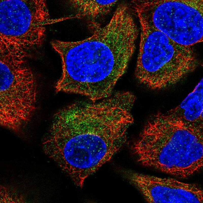 PSMB10/MECL1 Antibody - BSA Free Immunocytochemistry/ Immunofluorescence: PSMB10/MECL1 Antibody [NBP2-38155]