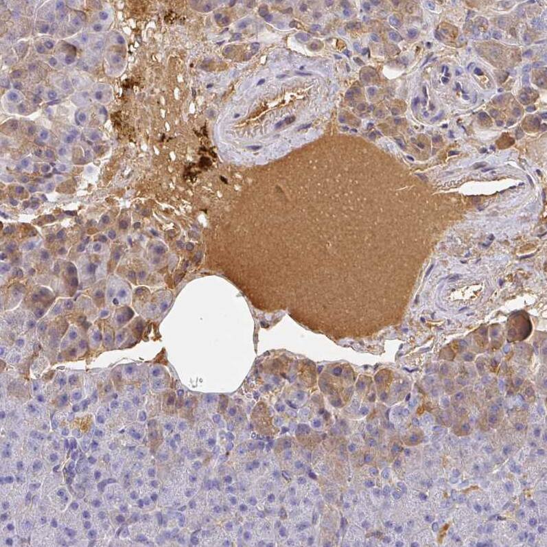 Albumin Antibody - BSA Free Immunohistochemistry-Paraffin: Albumin Antibody [NBP2-38174]