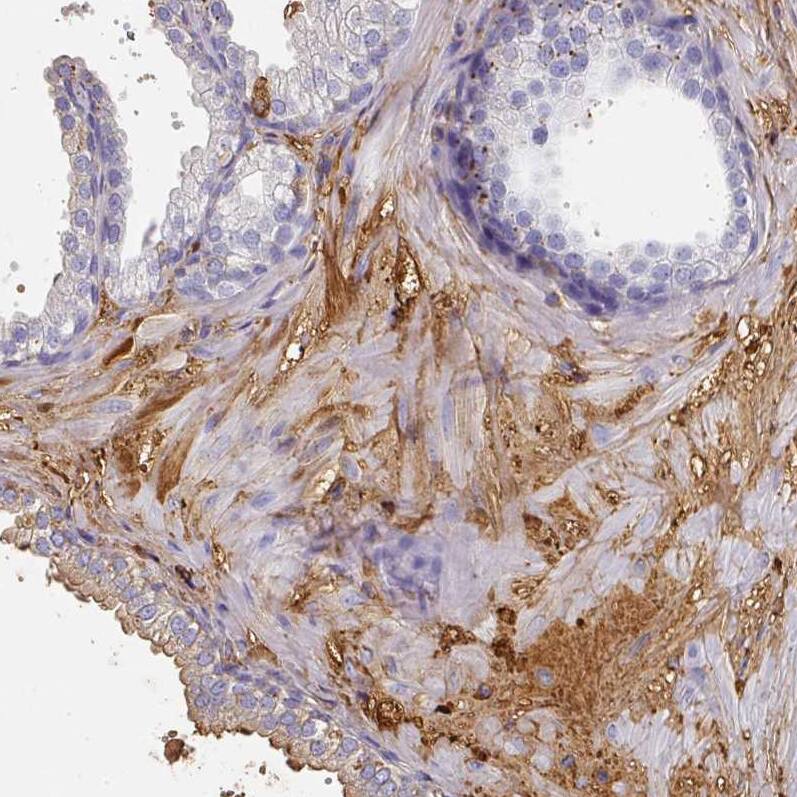 Albumin Antibody - BSA Free Immunohistochemistry-Paraffin: Albumin Antibody [NBP2-38174]