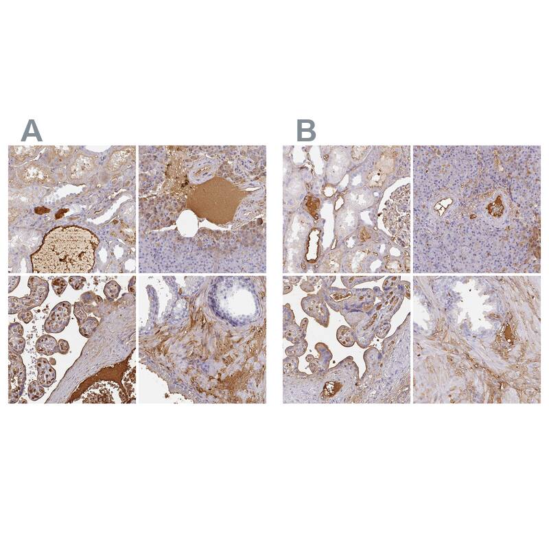 Albumin Antibody - BSA Free Immunohistochemistry-Paraffin: Albumin Antibody [NBP2-38174]