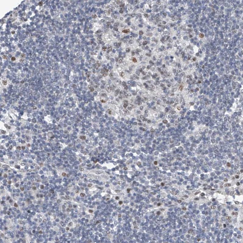 TAF8 Antibody - BSA Free Immunohistochemistry-Paraffin: TAF8 Antibody [NBP2-38189]