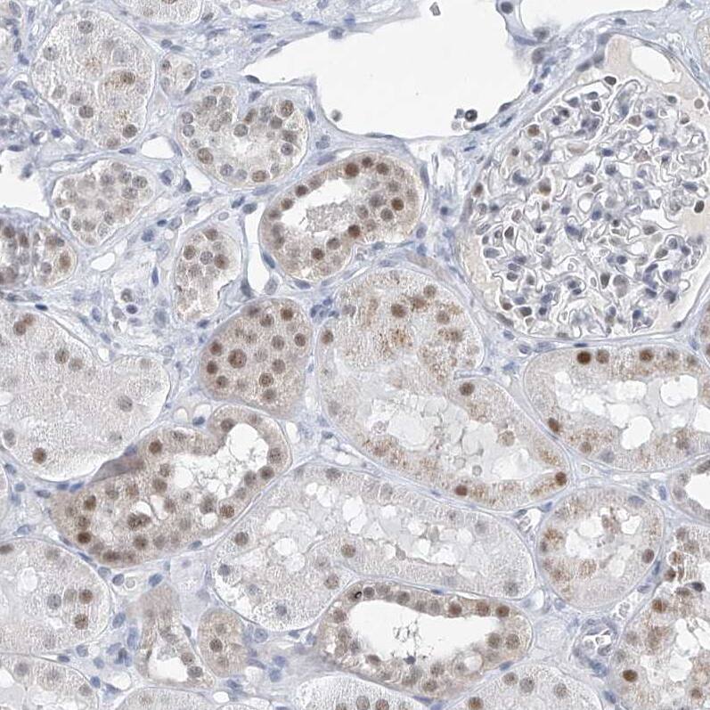 TAF8 Antibody - BSA Free Immunohistochemistry-Paraffin: TAF8 Antibody [NBP2-38189]