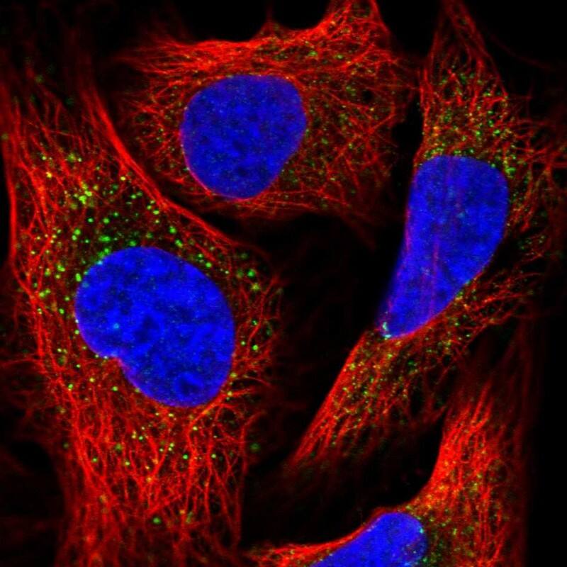 PEX13 Antibody - BSA Free Immunocytochemistry/ Immunofluorescence: PEX13 Antibody [NBP2-38204]