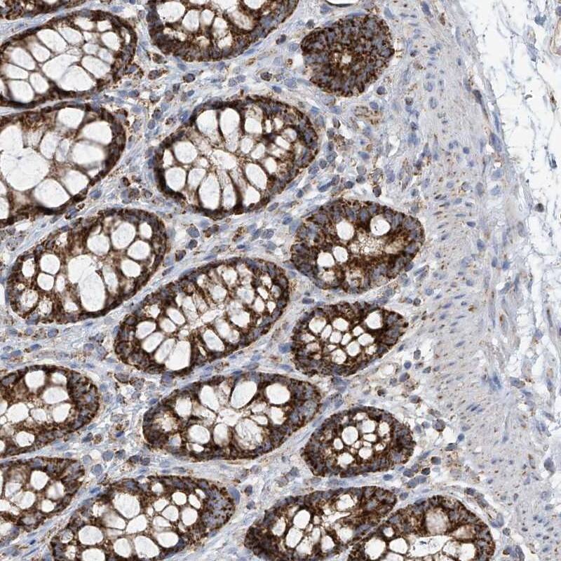PNPT1 Antibody - BSA Free Immunohistochemistry-Paraffin: PNPT1 Antibody [NBP2-38211]