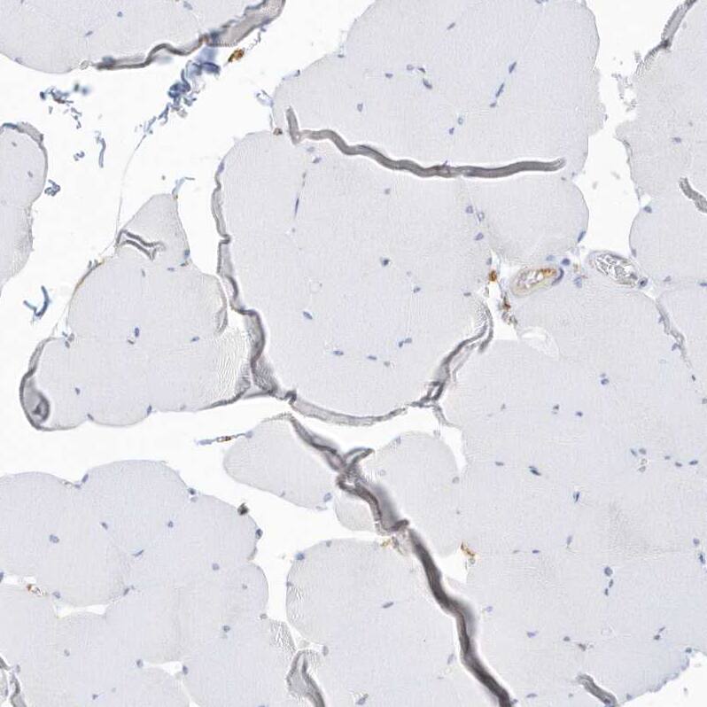 PDIA6 Antibody - BSA Free Immunohistochemistry-Paraffin: PDIA6 Antibody [NBP2-38213]