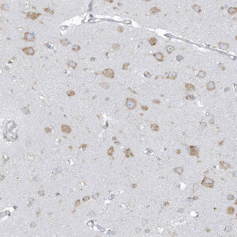 PDIA6 Antibody - BSA Free Immunohistochemistry-Paraffin: PDIA6 Antibody [NBP2-38213]