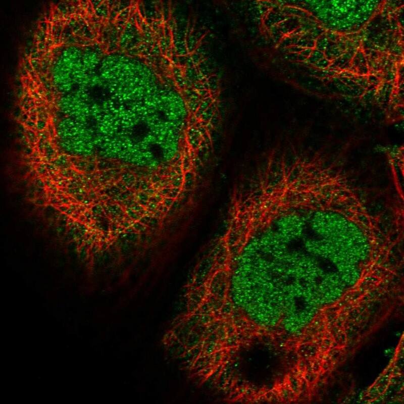 CSN7b Antibody - BSA Free Immunocytochemistry/ Immunofluorescence: CSN7b Antibody [NBP2-38214]