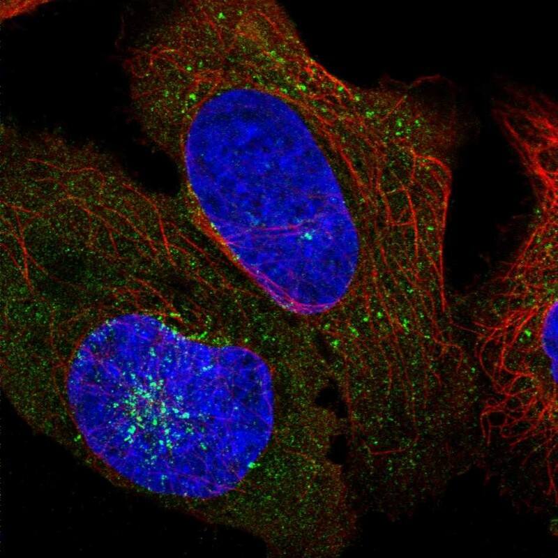 AFTPH Antibody - BSA Free Immunocytochemistry/ Immunofluorescence: AFTPH Antibody [NBP2-38227]