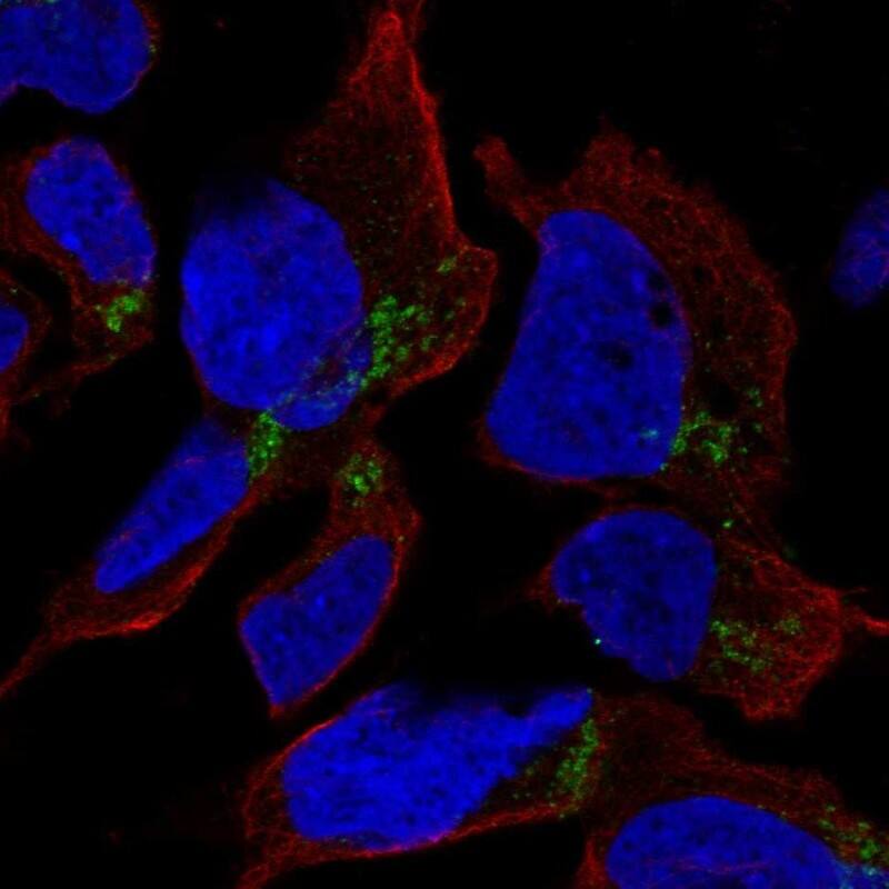 HFM1 Antibody Immunocytochemistry/ Immunofluorescence: HFM1 Antibody [NBP2-38228]