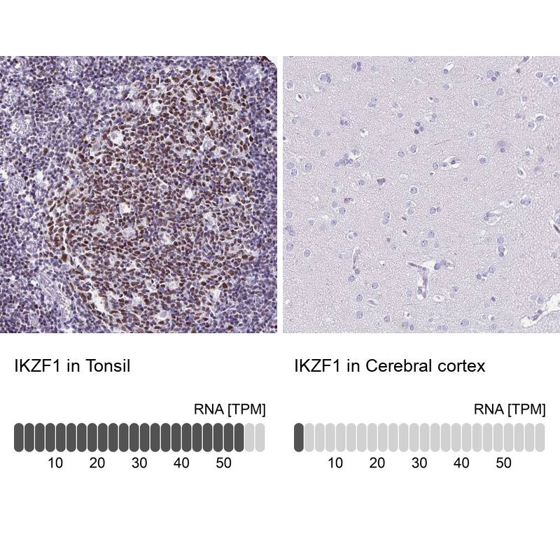 Ikaros/IKZF1 Antibody - BSA Free Immunohistochemistry-Paraffin: Ikaros/IKZF1 Antibody [NBP2-38241]