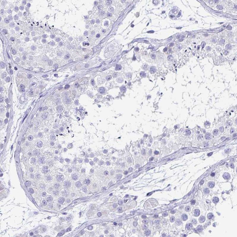 Ikaros/IKZF1 Antibody - BSA Free Immunohistochemistry-Paraffin: Ikaros/IKZF1 Antibody [NBP2-38241]