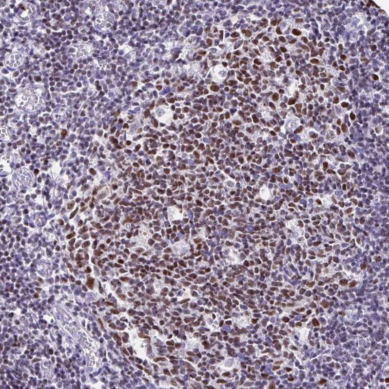 Ikaros/IKZF1 Antibody - BSA Free Immunohistochemistry-Paraffin: Ikaros/IKZF1 Antibody [NBP2-38241]