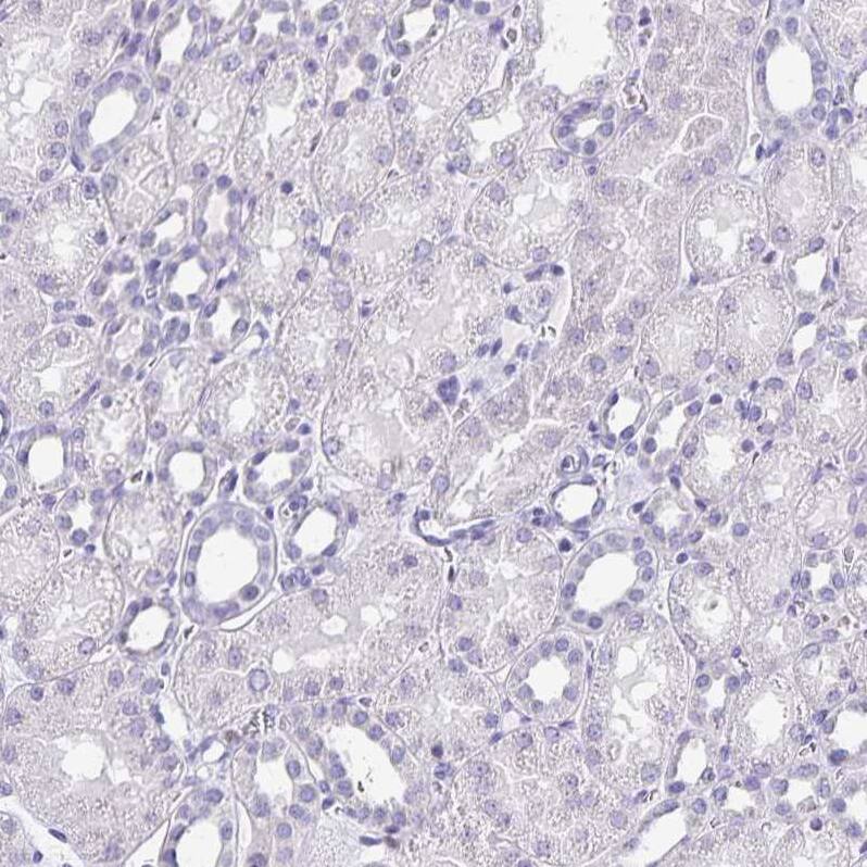 Ikaros/IKZF1 Antibody - BSA Free Immunohistochemistry-Paraffin: Ikaros/IKZF1 Antibody [NBP2-38241]