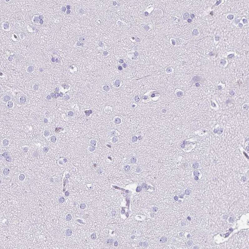 Ikaros/IKZF1 Antibody - BSA Free Immunohistochemistry-Paraffin: Ikaros/IKZF1 Antibody [NBP2-38241]