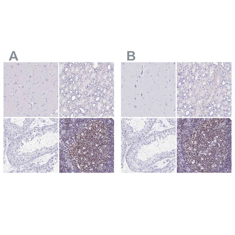 Ikaros/IKZF1 Antibody - BSA Free Immunohistochemistry-Paraffin: Ikaros/IKZF1 Antibody [NBP2-38241]