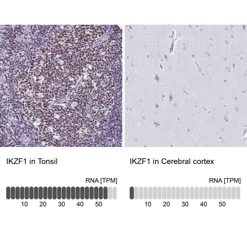 Ikaros/IKZF1 Antibody - BSA Free Immunohistochemistry-Paraffin: Ikaros/IKZF1 Antibody [NBP2-38242]