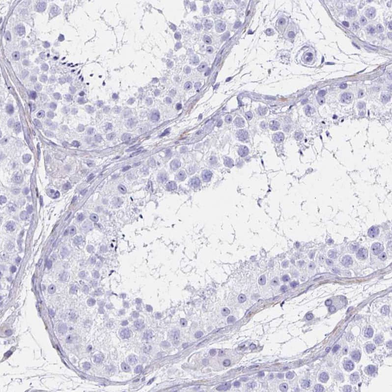 Ikaros/IKZF1 Antibody - BSA Free Immunohistochemistry-Paraffin: Ikaros/IKZF1 Antibody [NBP2-38242]