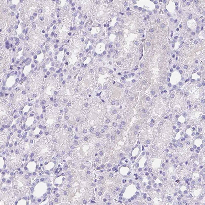Ikaros/IKZF1 Antibody - BSA Free Immunohistochemistry-Paraffin: Ikaros/IKZF1 Antibody [NBP2-38242]