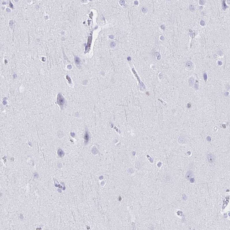 Ikaros/IKZF1 Antibody - BSA Free Immunohistochemistry-Paraffin: Ikaros/IKZF1 Antibody [NBP2-38242]