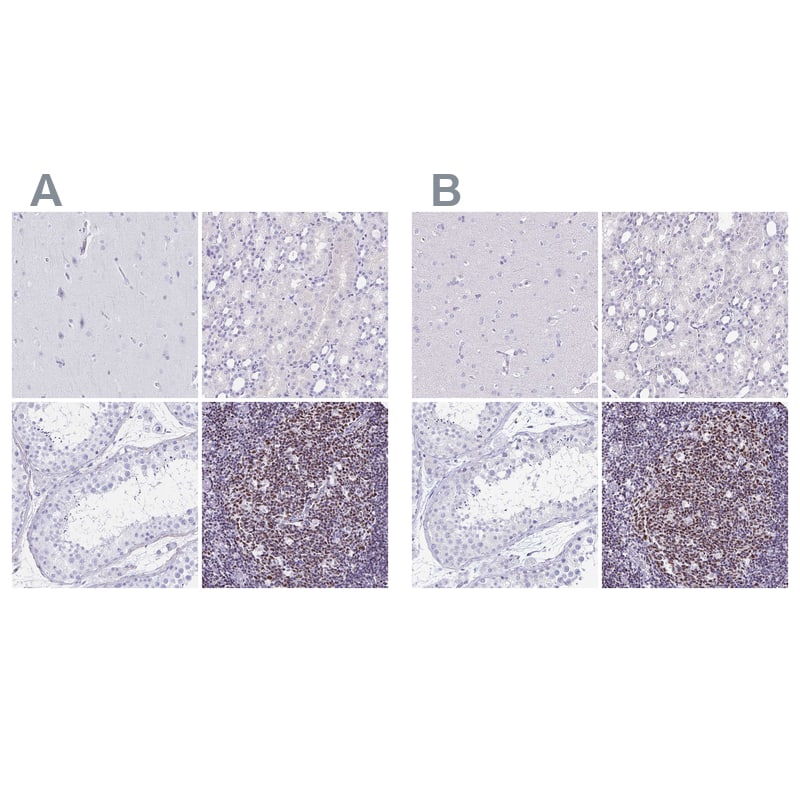 Ikaros/IKZF1 Antibody - BSA Free Immunohistochemistry-Paraffin: Ikaros/IKZF1 Antibody [NBP2-38242]