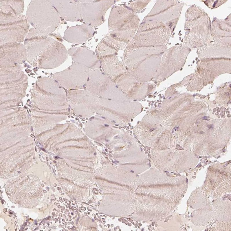 GRASP55 Antibody - BSA Free Immunohistochemistry-Paraffin: GRASP55 Antibody [NBP2-38244]