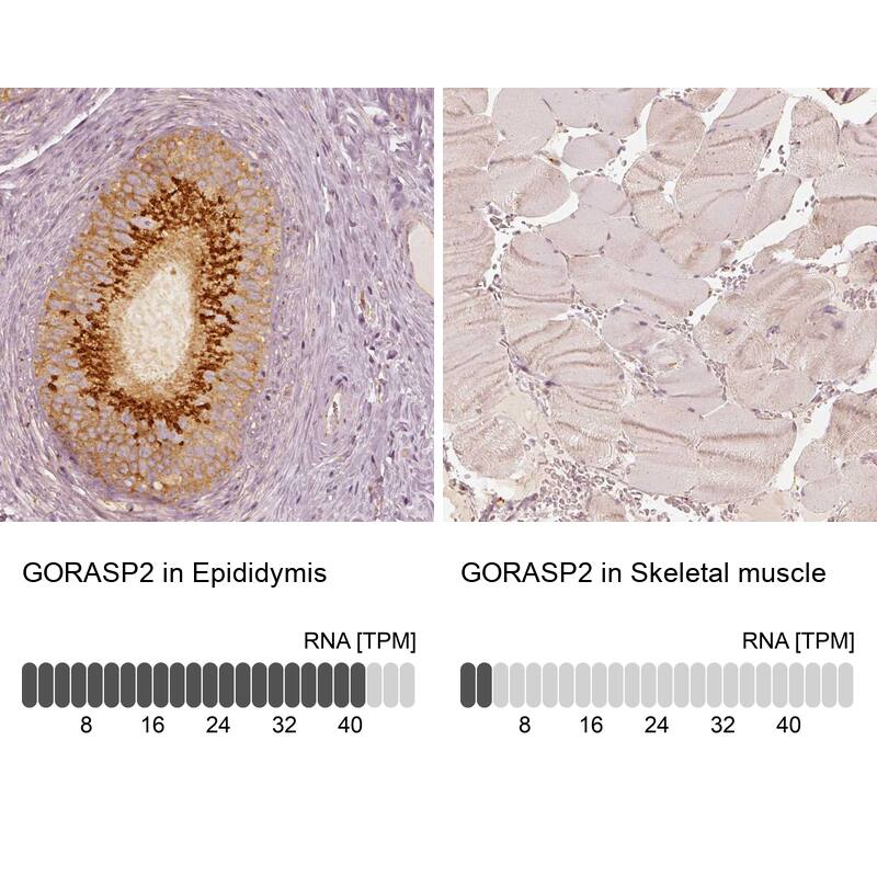 GRASP55 Antibody - BSA Free Immunohistochemistry-Paraffin: GRASP55 Antibody [NBP2-38244]