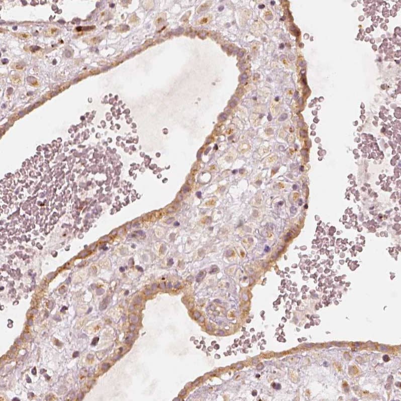 GRASP55 Antibody - BSA Free Immunohistochemistry-Paraffin: GRASP55 Antibody [NBP2-38244]
