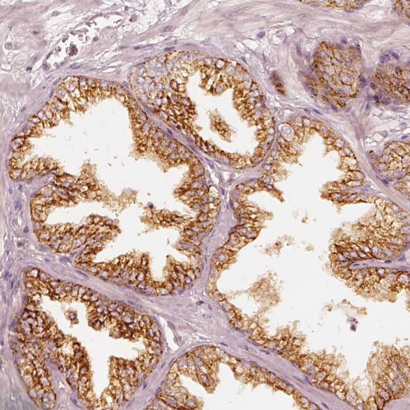 GRASP55 Antibody - BSA Free Immunohistochemistry-Paraffin: GRASP55 Antibody [NBP2-38244]