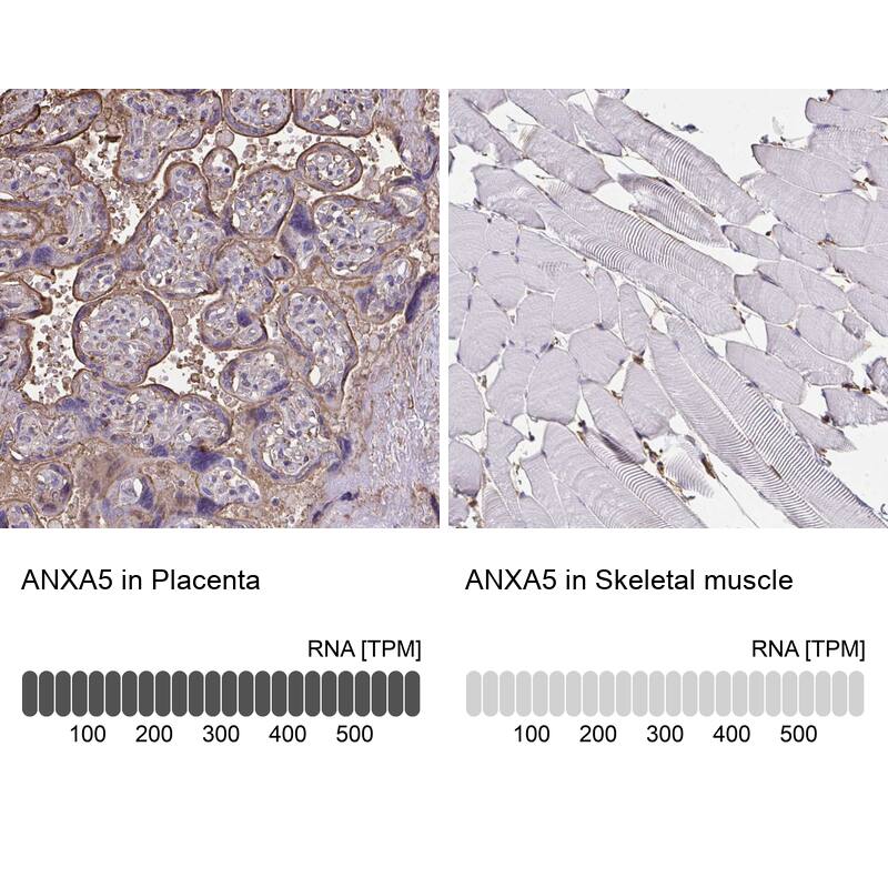 Annexin V Antibody - BSA Free Immunohistochemistry-Paraffin: Annexin V Antibody [NBP2-38248]