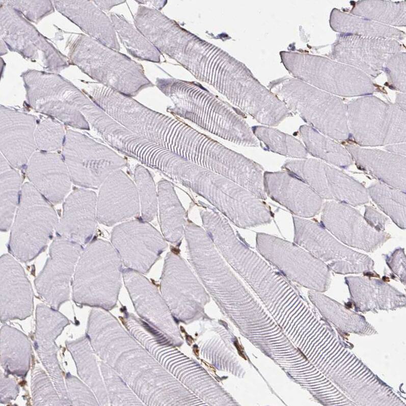 Annexin V Antibody - BSA Free Immunohistochemistry-Paraffin: Annexin V Antibody [NBP2-38248]