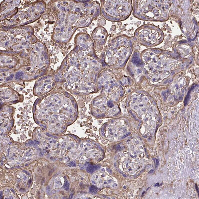 Annexin V Antibody - BSA Free Immunohistochemistry-Paraffin: Annexin V Antibody [NBP2-38248]