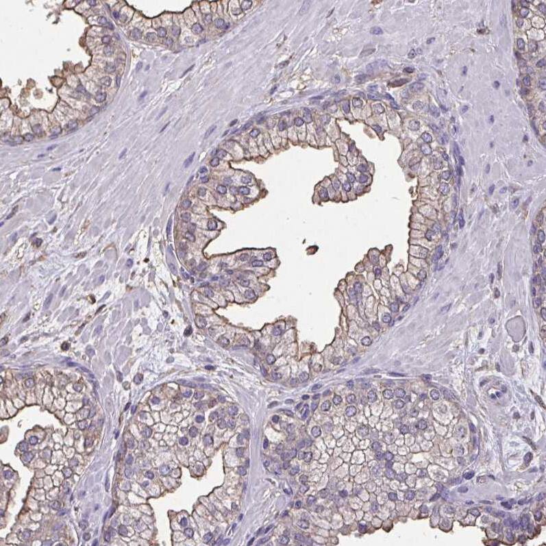Annexin V Antibody - BSA Free Immunohistochemistry-Paraffin: Annexin V Antibody [NBP2-38248]