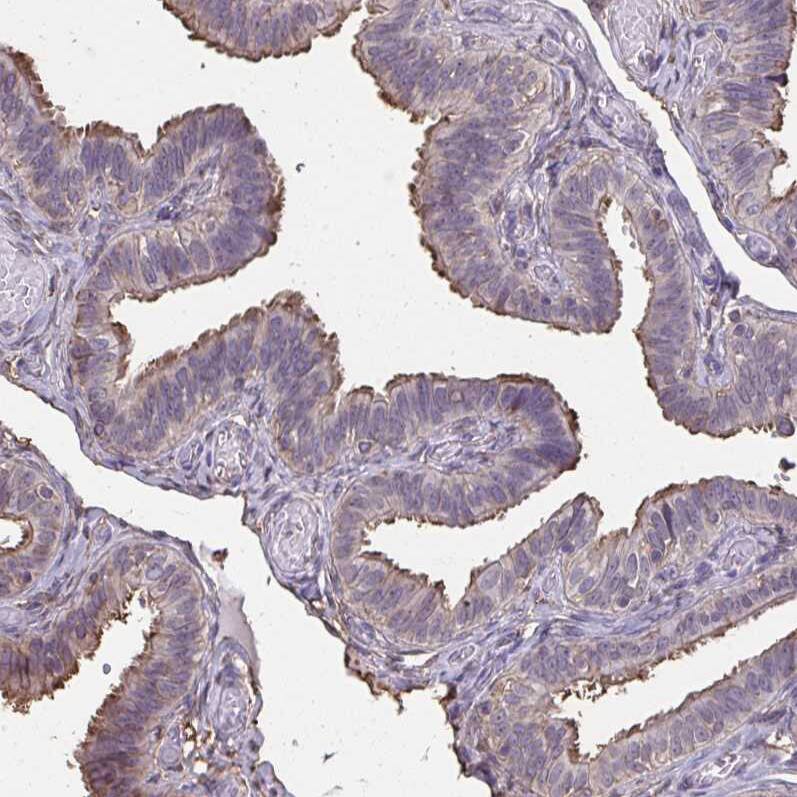 Annexin V Antibody - BSA Free Immunohistochemistry-Paraffin: Annexin V Antibody [NBP2-38248]