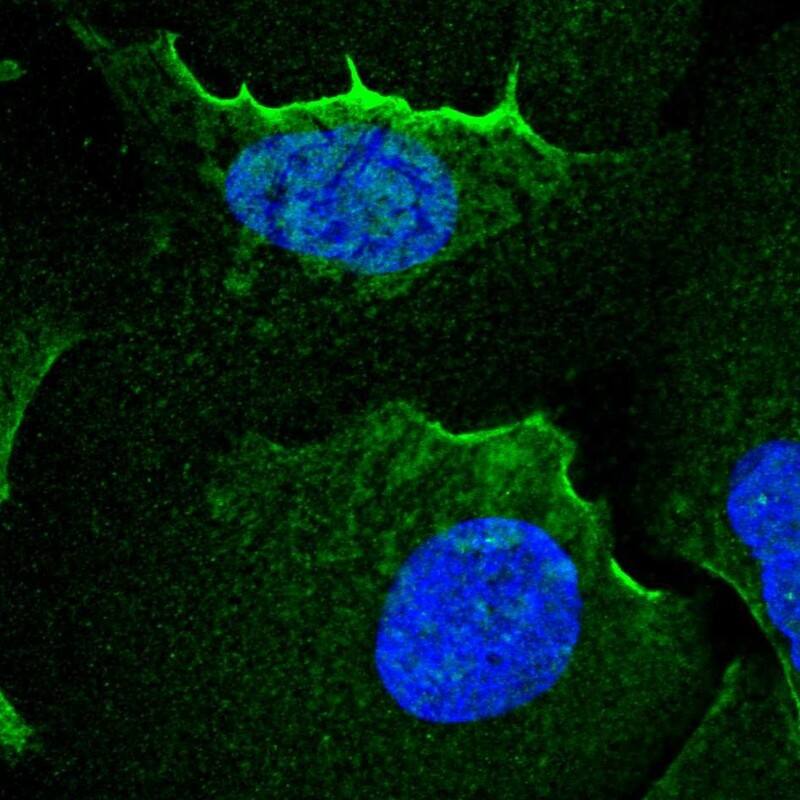 alpha Adducin Antibody - BSA Free Immunocytochemistry/ Immunofluorescence: alpha Adducin Antibody [NBP2-38268]
