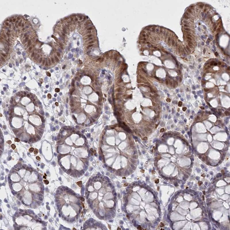 FAM206A Antibody - BSA Free Immunohistochemistry-Paraffin: FAM206A Antibody [NBP2-38273]