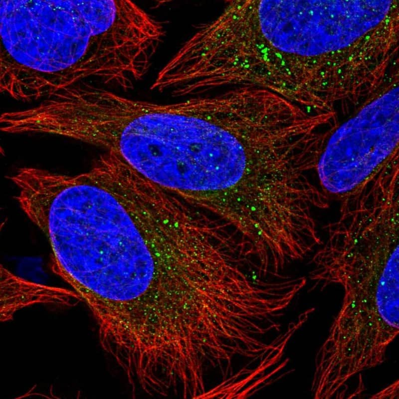 PIK3R4 Antibody - BSA Free Immunocytochemistry/ Immunofluorescence: PIK3R4 Antibody [NBP2-38276]